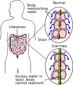 Relieving Diarrhea with Natural Remedies