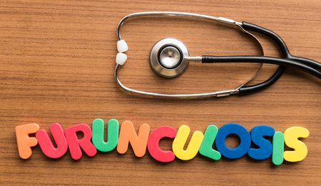 56792368 s e1486582742179