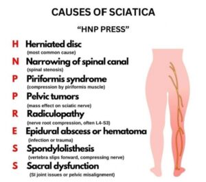 The Main Cause of Sciatica Symptoms Diagnosis and Effective Relief Options The Main Cause of Sciatica Symptoms Diagnosis and Effective Relief Options